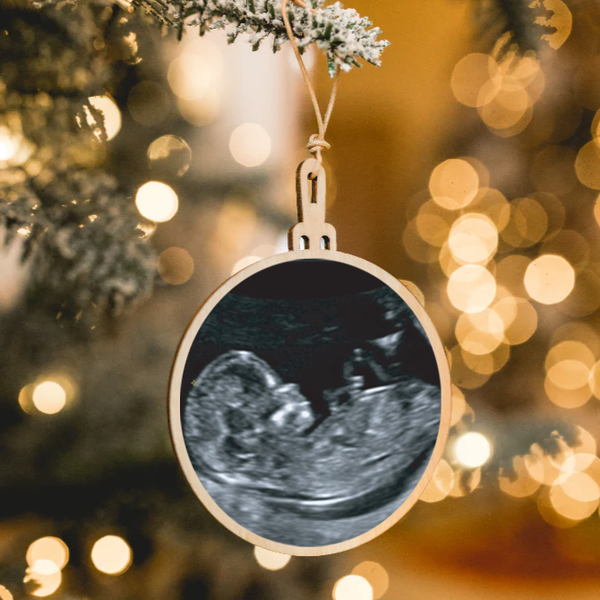 Baby Sonogram Ornament Photo Christmas Bauble Ultrasound – T-Leaf
