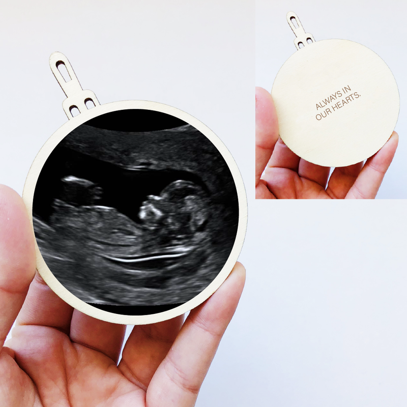 Photo Christmas Bauble - Ultrasound Double Sided